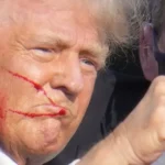 Po 14 mesiacoch od atentátu na Trumpa zomrel zranený účastník