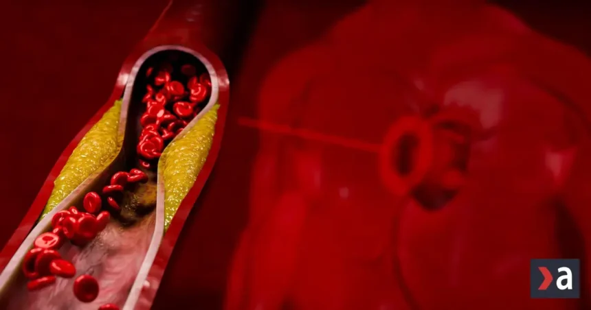 Tiché signály na koži a očiach: Ako odhaliť vysoký cholesterol včas?