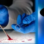DNA v službách kriminalistov – páchatelia ani po desaťročiach nemajú istotu odhalenia