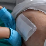 Prevencia šetrí milióny: Slovensko má tisíce pacientov s preležaninami